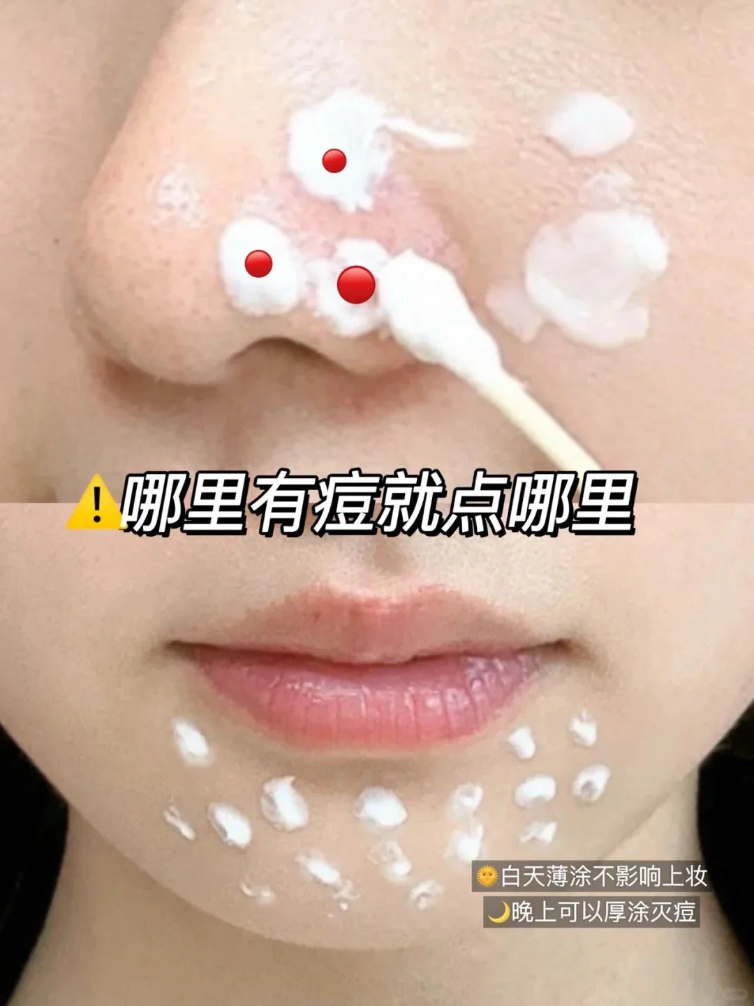 Japan Lion PAIR Acne Cream|日本狮王PAIR祛痘膏