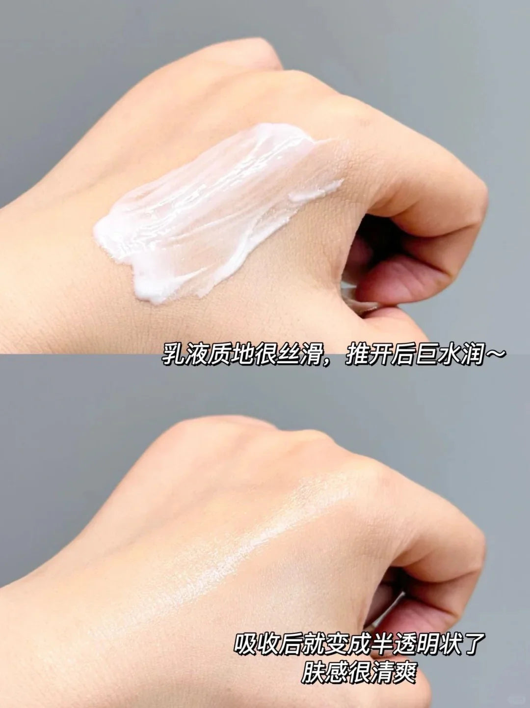 Japan Lion PAIR Acne Cream｜日本狮王PAIR祛痘膏