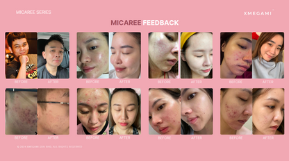 MICAREE OT Cream Skin Treatment ｜养白霜